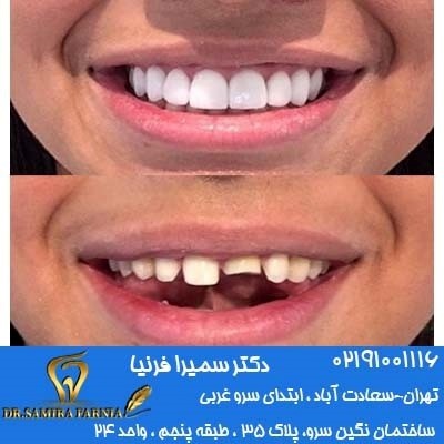 دندانپزشک خوب در سعادت آباد