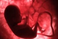 دود اگزوز خودرو به بارداری زنان آسیب می زند