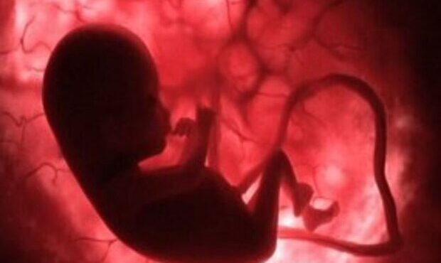 دود اگزوز خودرو به بارداری زنان آسیب می زند