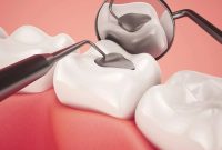 تولید مایعی که از پوسیدگی دندان جلوگیری می‌کند