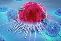 تداوم افزایش موارد ابتلا به سرطان در جهان
