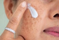 لکه‌های پوستی بارداری؛ چرا و چگونه پیشگیری کنیم؟