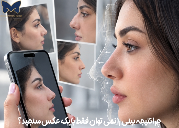 چرا نتیجه بینی را نمی توان با یک عکس سنجید؟